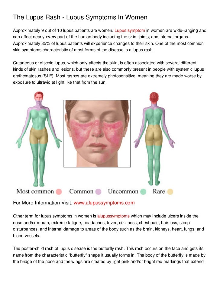 breast augmentation and arthritis Xray teen pics